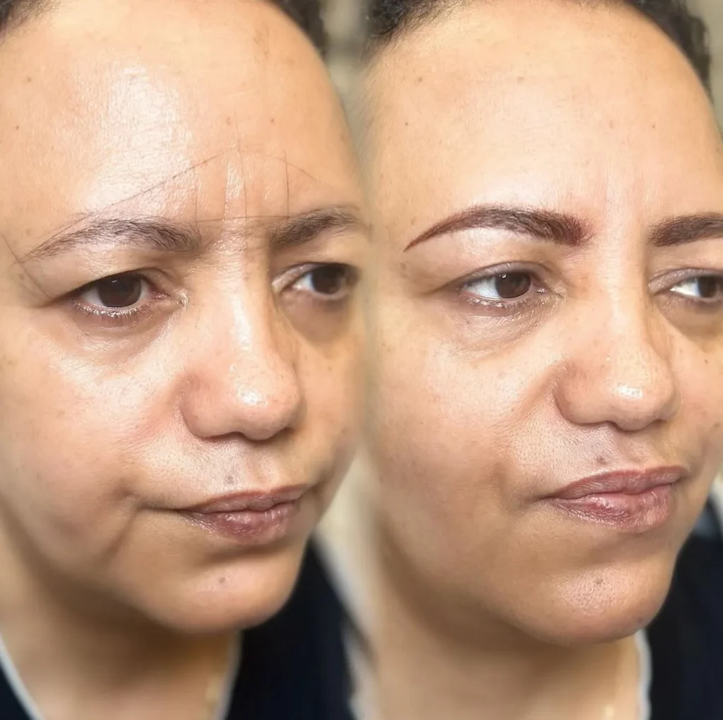 Is It Possible to Refresh Overdone Brow Tattoos on Mature Faces?